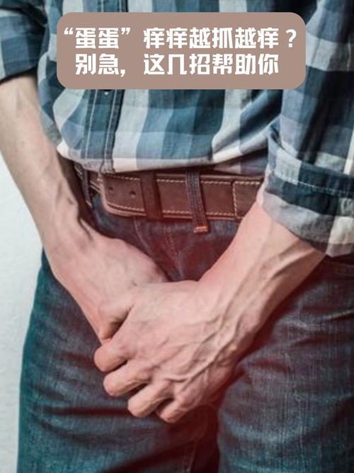 马雷斯卡比赛中手插裤兜挠私处，球迷吐槽：他的蛋蛋总是很痒